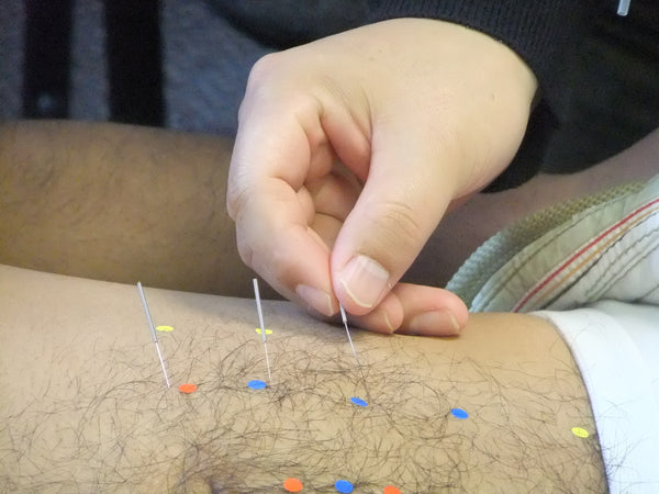 Introduction to Abdominal Acupuncture, Palpation & Diagnosis