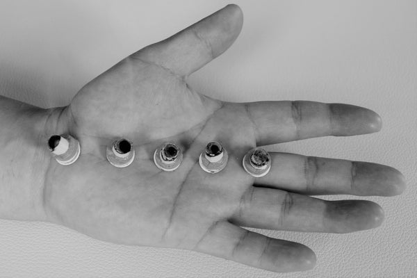 Moxibustion in a Clinical Setting: A Day of Theory & Practice