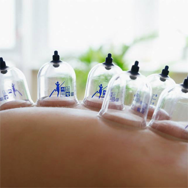 Introduction to Cupping Therapy and Body Gua Sha