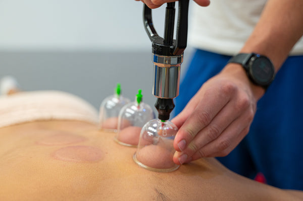 Introduction to Cupping Therapy and Body Gua Sha
