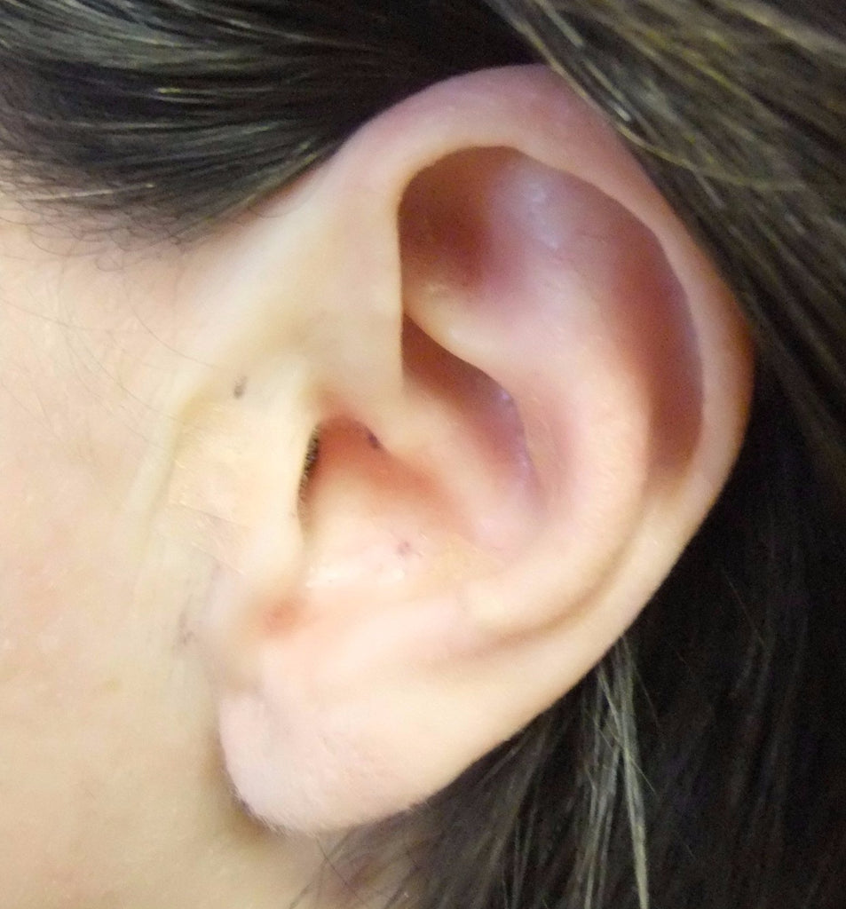 Korean Auricular Therapy INTRODUCTORY LEVEL