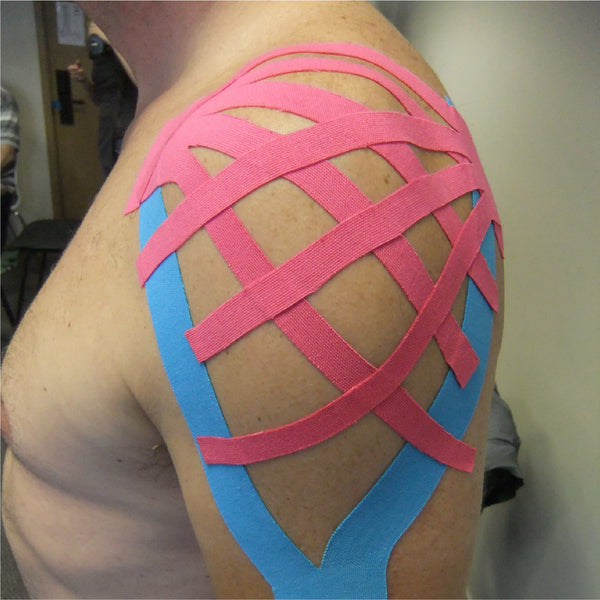 Muscle Taping Therapy